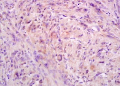 Gab1 Rabbit Polyclonal Antibody